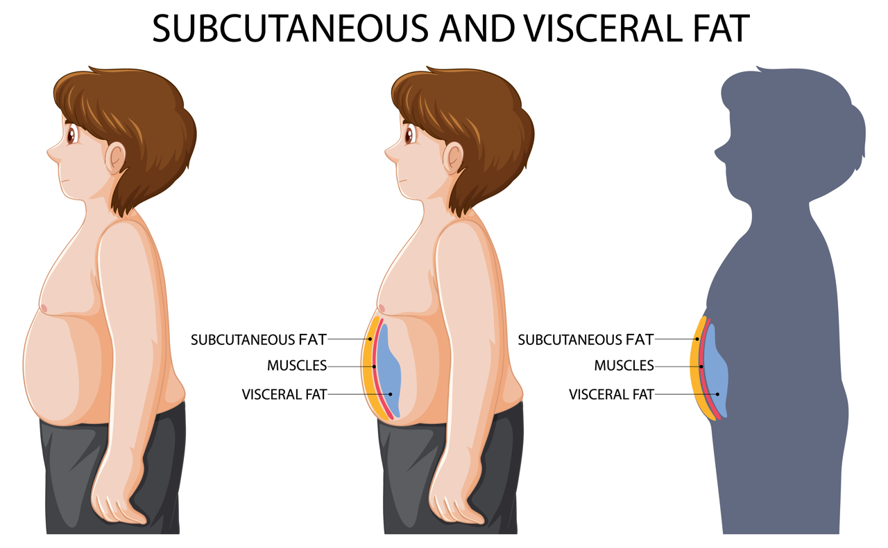 What is visceral fat?