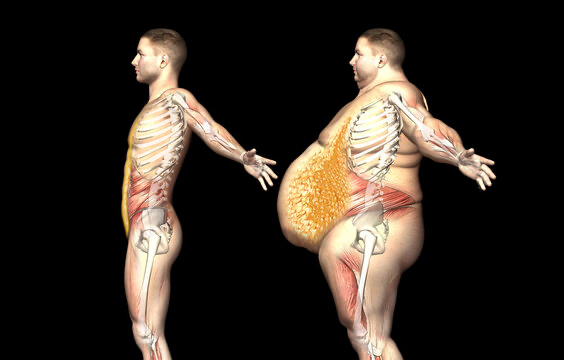 visceral and subcutaneous fat pictures